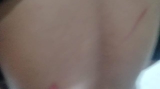 Percuma Lapor Polisi, Orang Tua Korban Pengeroyokan Kecewa