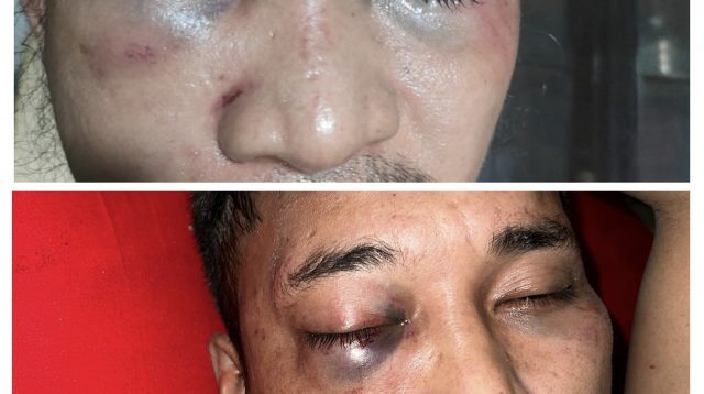 Kinerja Polrestabes Makassar Disorot, Kuasa Hukum Korban Minta Polisi Bertindak Profesional